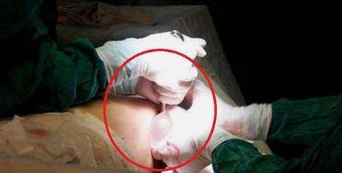 国产精子精视频播放,揭秘生育科技新篇章